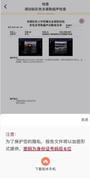 怎么查看报告 怎么查看报告